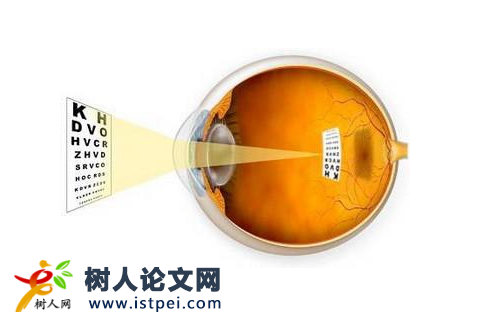 有研究弱視的課題嗎